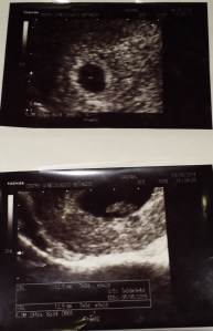 ecografias5y8semanas